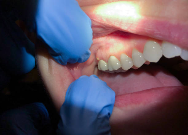 Best Emergency Cosmetic Dentistry (e.g., broken veneers) in North Ogden, UT